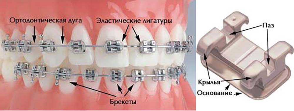 ортодонтия-для-детей-и-взрослых