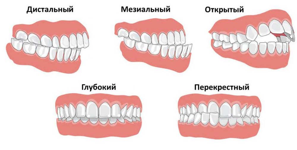 ортодонтия-для-детей-и-взрослых