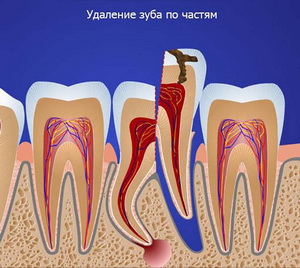 хирургическая-стоматология-имплантация